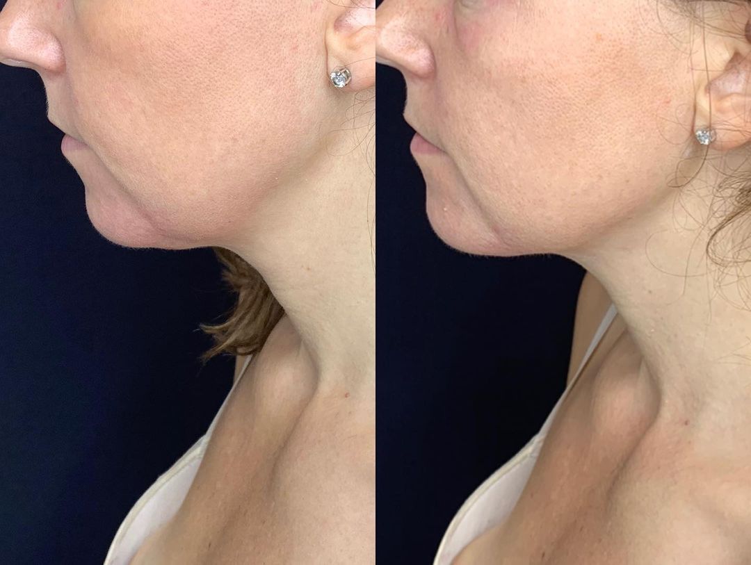 122317648_208793953939968_152111851324944205_n