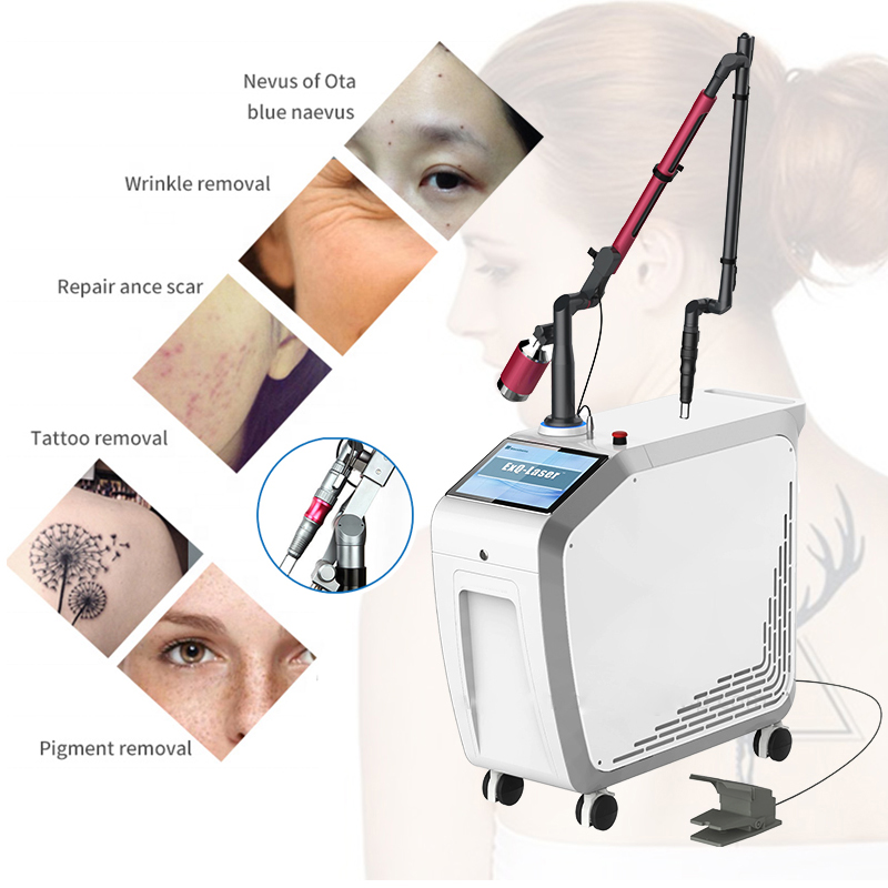1064 nm 532nm Nd Yag Laser Picosecond laser   tattoo removal agents required nd yag q-switch laser machine width FDA Medcial CE Approved Pigmentation treatment